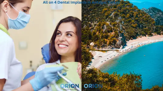 All on Four dental implant in Turkey