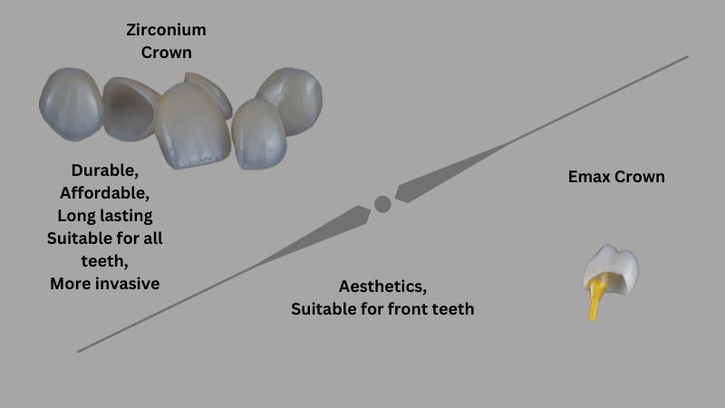 Emax crowns vs. zirconia crowns Turkey