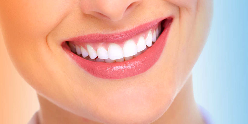 Hollywood Smile