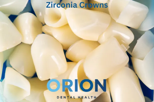 Zirconia crowns