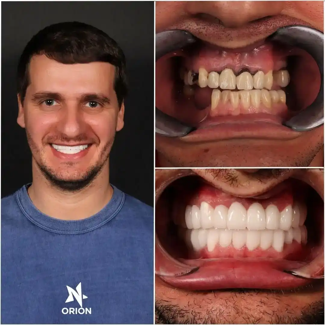 dental before after image