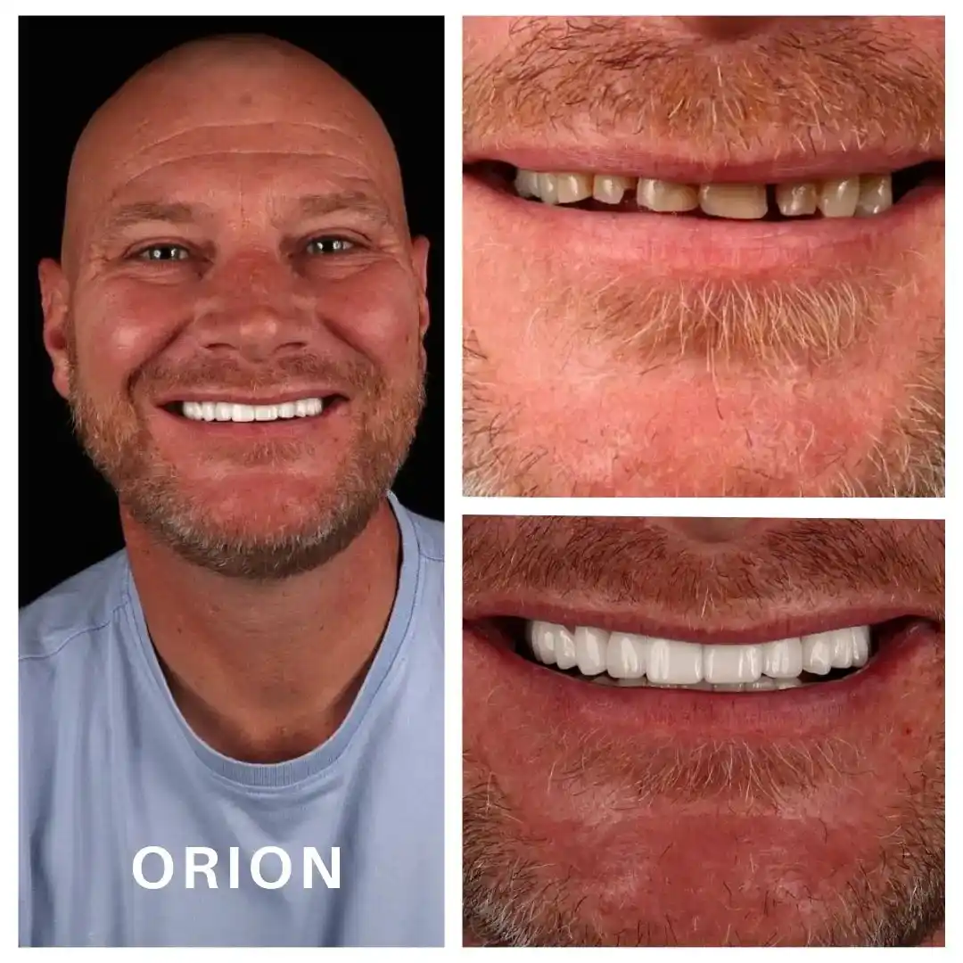 dental before after image