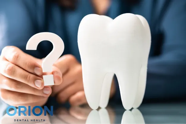 all on 6 dental implants faq